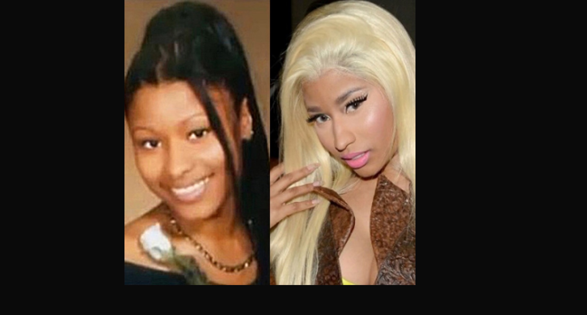 CAROLINE_MUTOKO_BLEACHED_CELEBRITIES.png