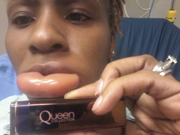 Covergirl-queen-allergic-reaction.jpg