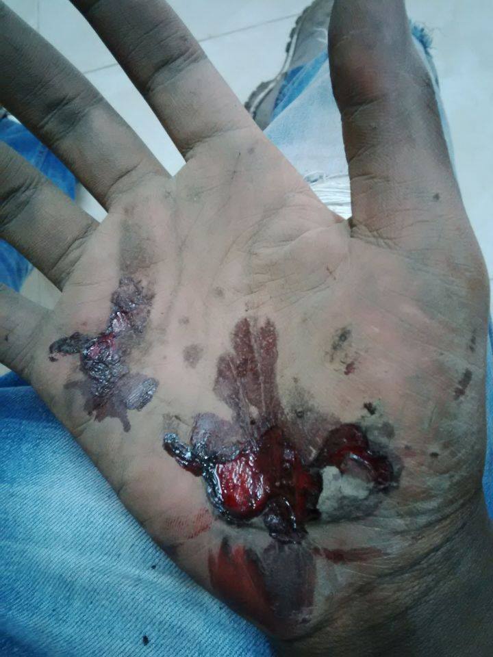 OJ_INJURIES.jpg