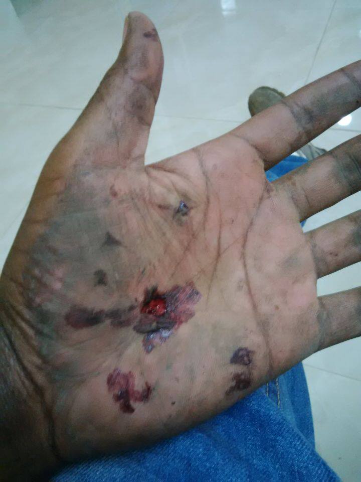 OJ_INJURIES_2.jpg