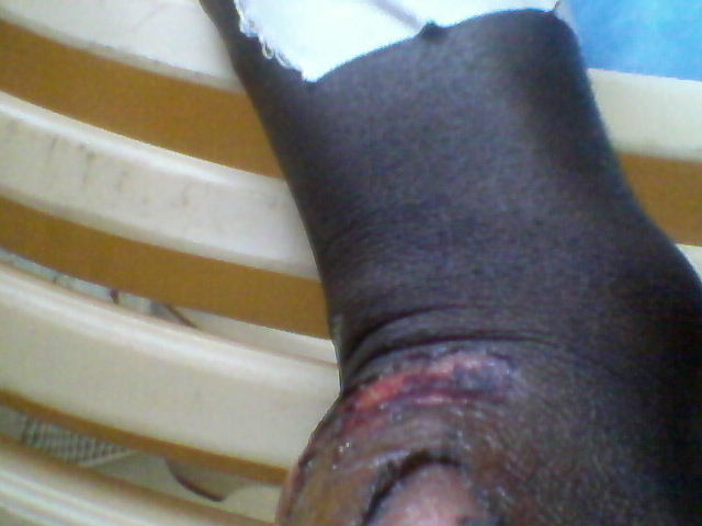 arm4