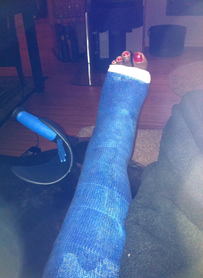 christine_apondi_leg_2.jpg