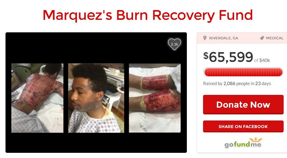 marquez_burnt.JPG