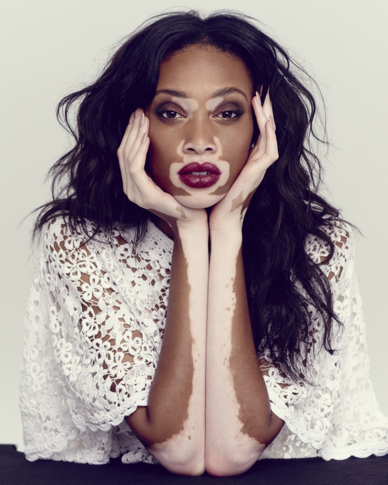 winnie-harlow-the-observer-photos1.jpg