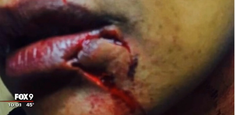 wound.jpg