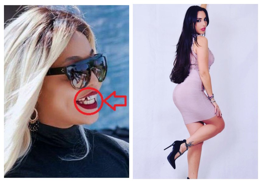 “Please go see a dentist” Drama continues as Harmonize’s girlfriend savagely attacks Jacqueline Wolper