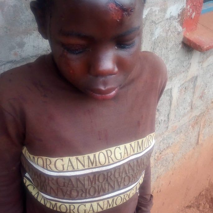 The 13-year-old boy who was assaulted