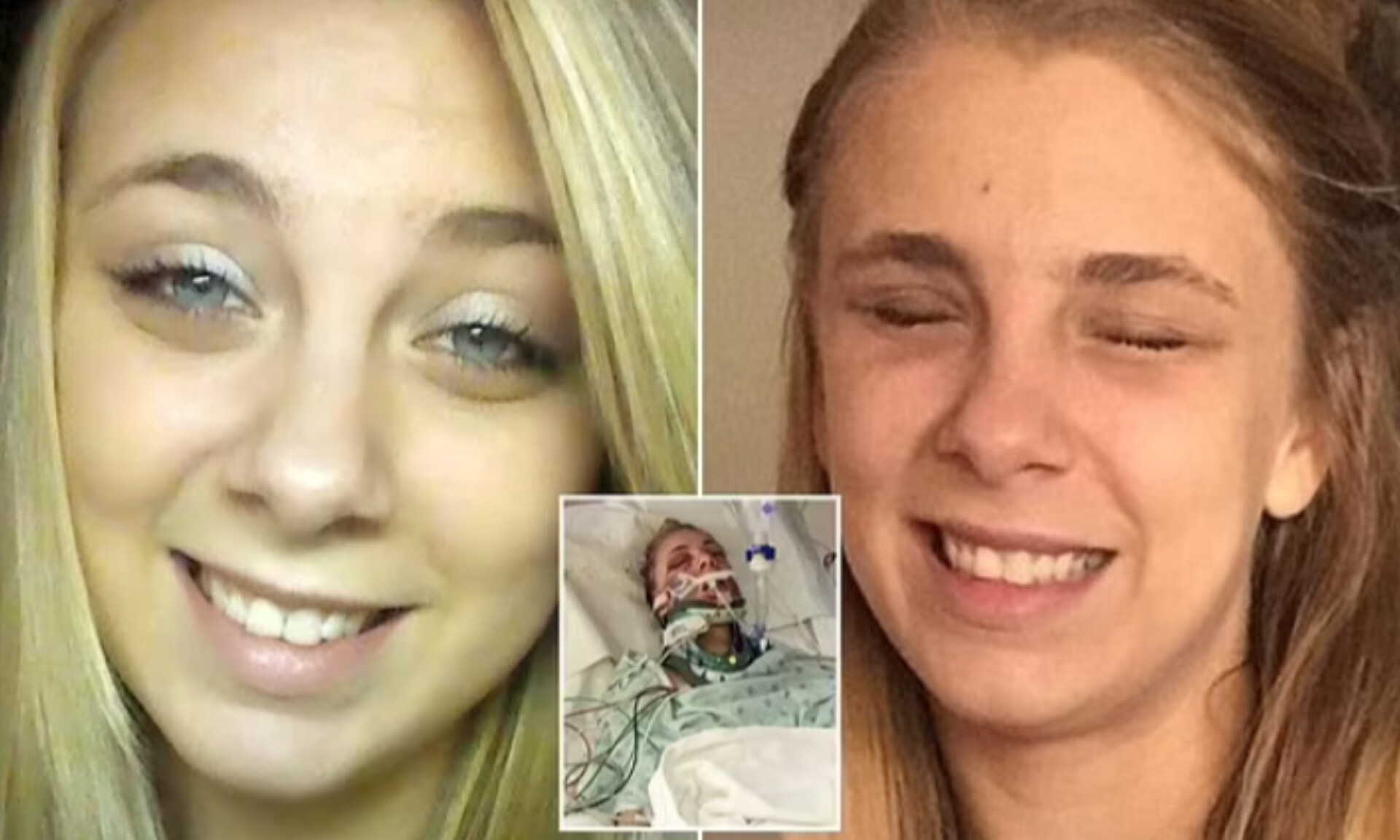 A-Student Claws Her Eyeballs out While High on Drugs