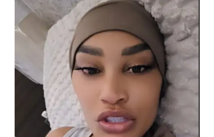 Zari Hassan Defends Recent Face Procedure After Social Media Backlash