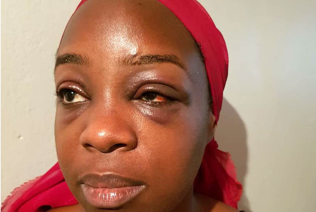 Angella Katatumba Beaten and Robbed at chicken Tonight