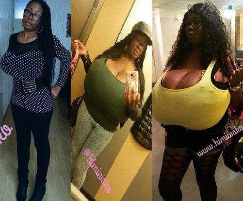 IG model reveals the condition which has made her breasts grow bigger than a kiondo basket in just 4 years (Photos)