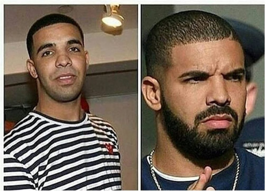 Drake without and with beards