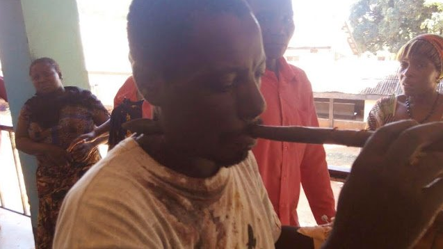 Man speared straight in the mouth by Masai men survives and discharged from hospital
