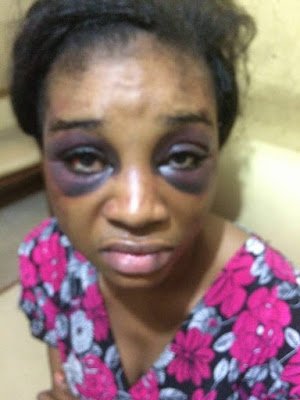 woman-beaten-by-husband