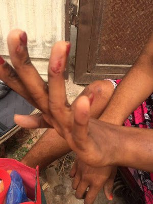 woman-beaten-senseless