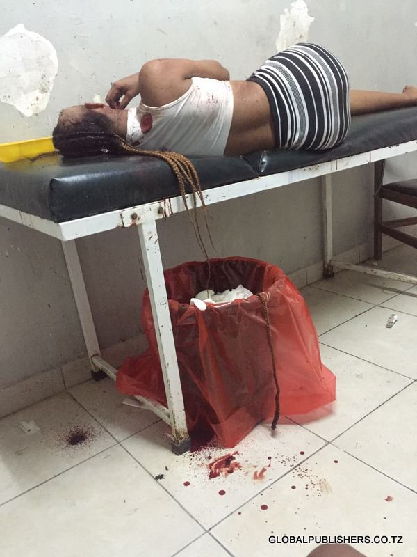 Tanzanian model attacked and cut into the head by a gang