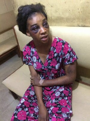 woman-battered