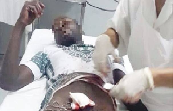 She knifed it like a piece of cake! The incident in Mombasa is the scariest of all the stories you have heard about wives chopping off their husband’s manhood (Photo)
