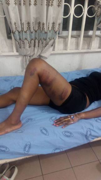 Popular Actress Hospitalized after being mercilessly beaten by soldier who was apparently in a bad mood