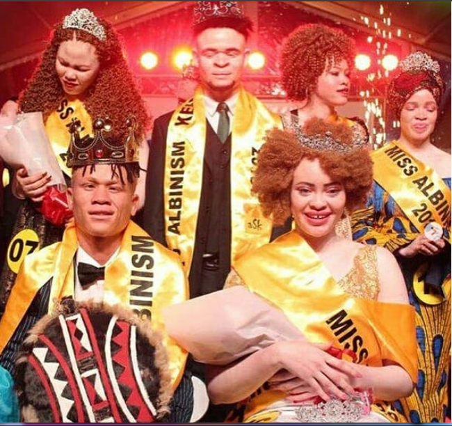 Tanzania Kuibuka Kidedea Miss Albinism Afrika 2018