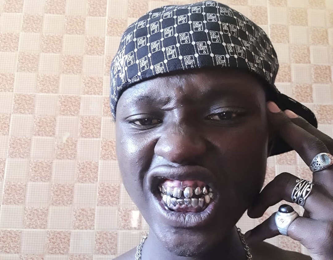 ‘Heirras gonna hate;’ Wizzo Tanonane reveals huge amount he spent on his Silver teeth caps