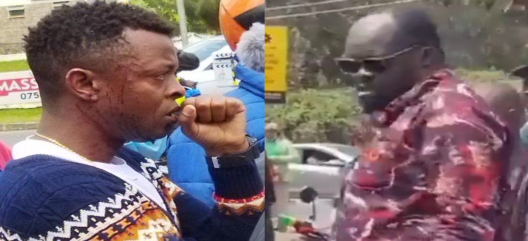 Nikikufa Mjue Ni Alai Ameniua- Ringtone In Tears As He Complains Of Severe Headache Where He Was Hit By Alai(Video)
