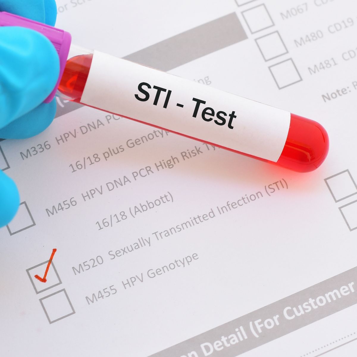 Why super gonorrhoea scares Nairobians senseless