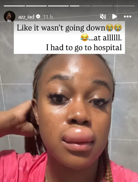 What Happened to Azziad? Fans Speculate on ‘Spiritual Transaction’ and Botched Lip Filler
