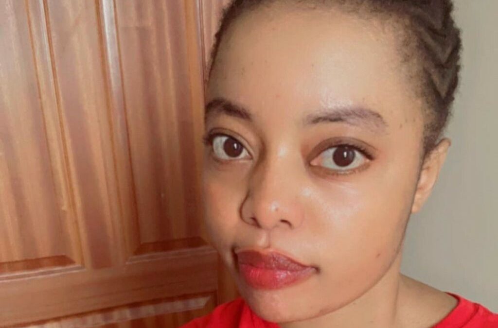 Gloria Ntazola Warns Fans About Life-Threatening Risks Of Cosmetic Surgery