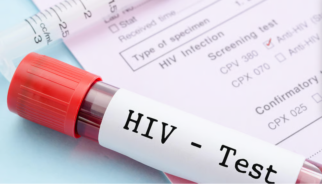 Kenya Records 54 New HIV Infections Daily as Death Toll Raises Concern
