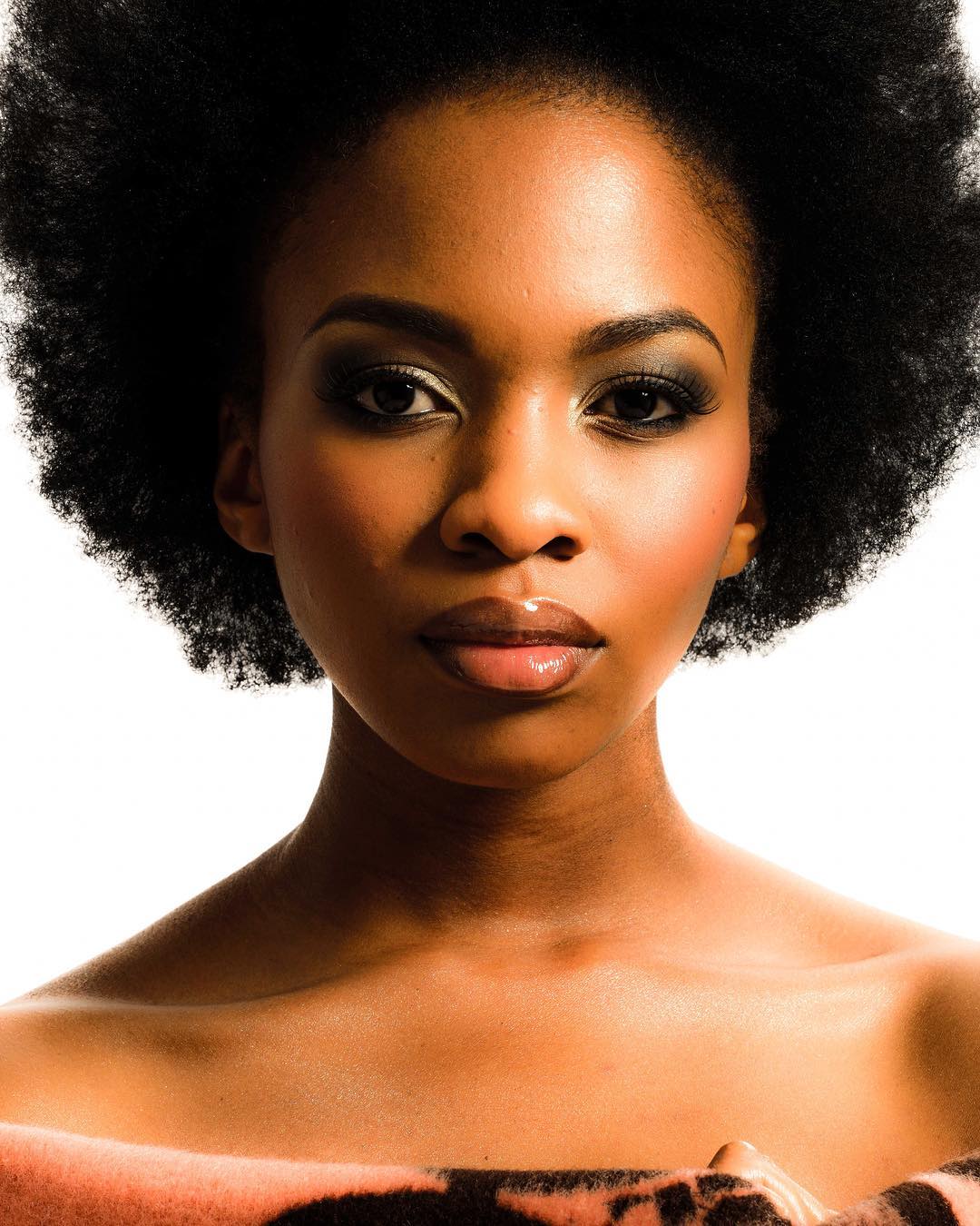 Pasi Koetle speaks on acne struggle