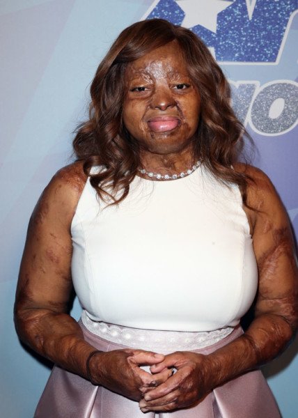 Don’t Vote for me Based on my Story…There are Better Singers on the Show- Kechi Okwuchi