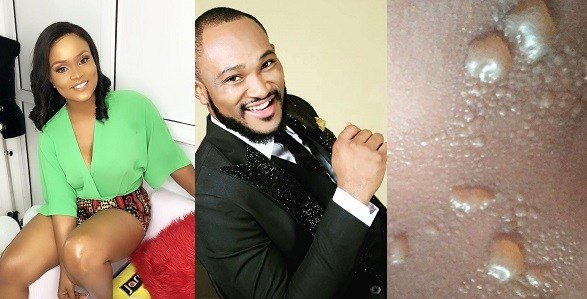 Actor, Blossom Chukwu’s Wife Recounts Near Death Experience