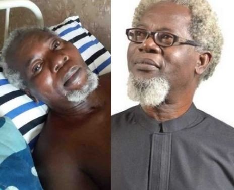 Actor Victor Olaotan needs financial aid to seek for medical treatment following a ghastly accident